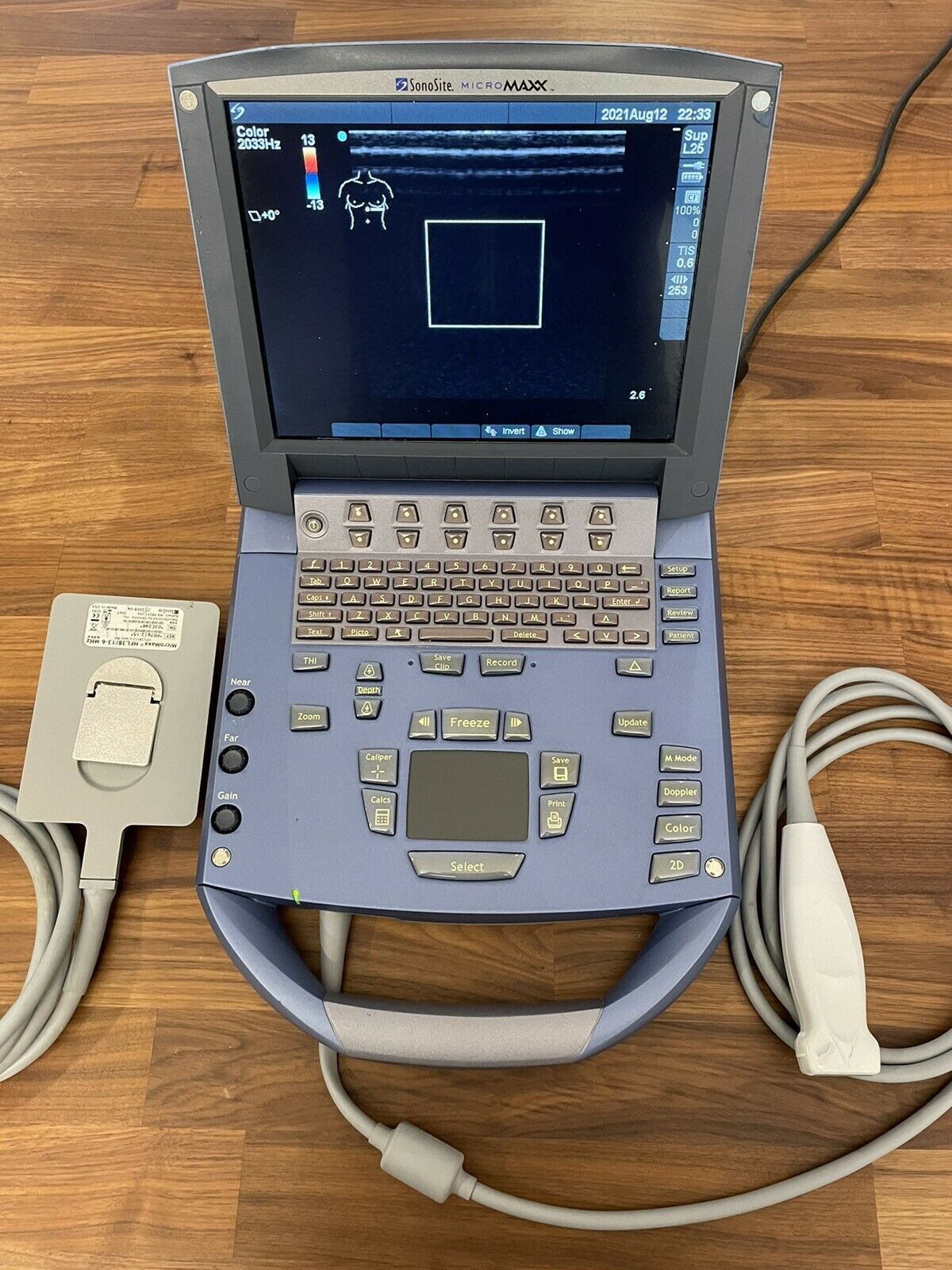 SONOSITE MICROMAXX 2008 CW DOPPLER W/ 2 Probes PORTABLE ULTRASOUND DIAGNOSTIC ULTRASOUND MACHINES FOR SALE