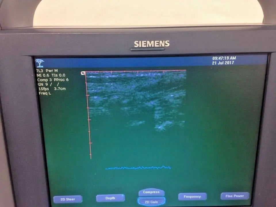 Siemens Acuson Plus Rev 20 Ultrasound Machine. BIOMED Certified. Echocardiogram DIAGNOSTIC ULTRASOUND MACHINES FOR SALE