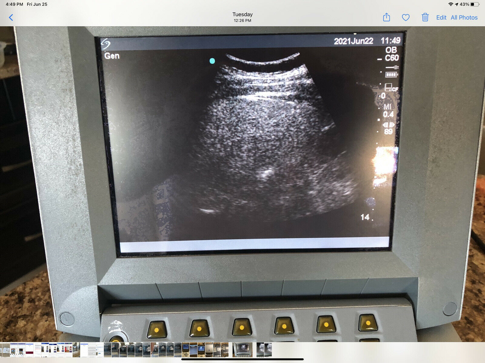 Sonosite Titan Portable Ultrasound Machine With Convex Probe C60/5-2mhz Probe DIAGNOSTIC ULTRASOUND MACHINES FOR SALE