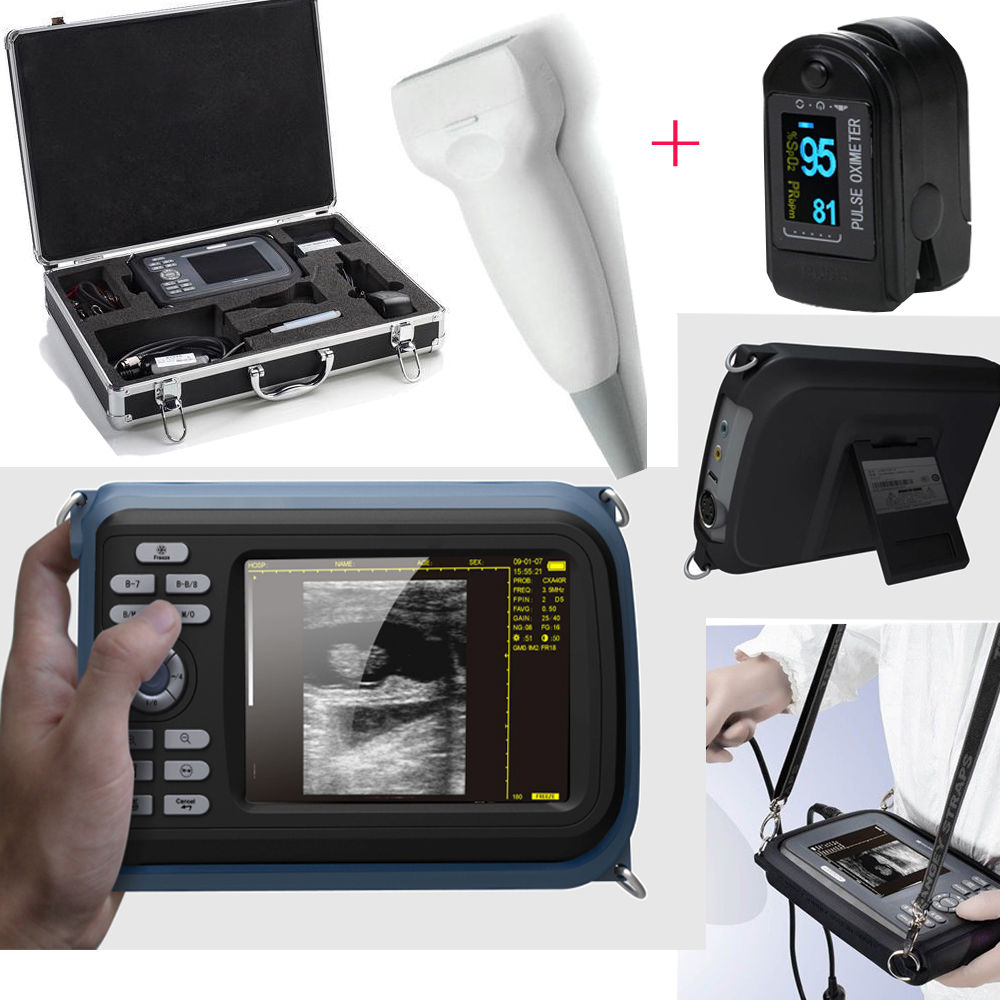 Medical Handheld Digital Ultrasound Scanner Machine Linear Probe+ US PR Oximeter 190891041111 DIAGNOSTIC ULTRASOUND MACHINES FOR SALE