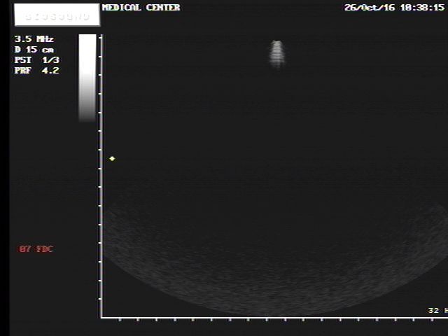 Esaote Biosound Megas/ MyLab ultrasound PA220 cardiac probe DIAGNOSTIC ULTRASOUND MACHINES FOR SALE