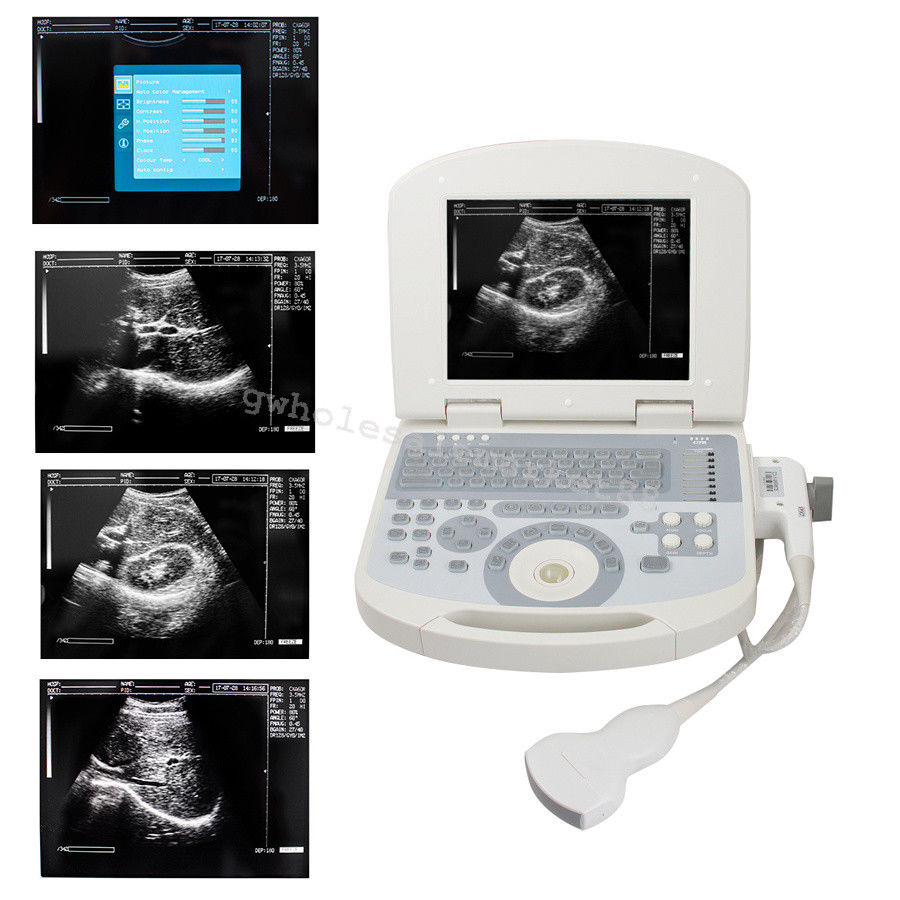 Laptop Ultrasound Machine Scanner Convex Probe 3D Software Clear Medical Clinic 190891045898 DIAGNOSTIC ULTRASOUND MACHINES FOR SALE