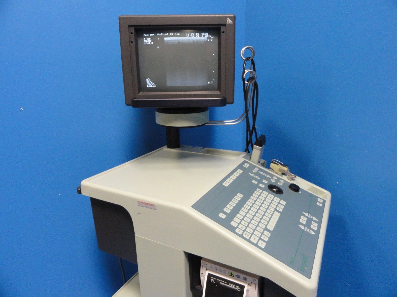 BK Medical Leopard 2001 Ultrasound W/ 8451& 8560 Linear Probes &Printer (11449) DIAGNOSTIC ULTRASOUND MACHINES FOR SALE