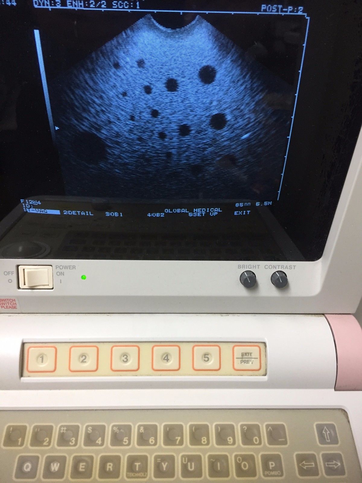 Hitachi EUP-V33 Intercavity Ultrasound Probe DIAGNOSTIC ULTRASOUND MACHINES FOR SALE