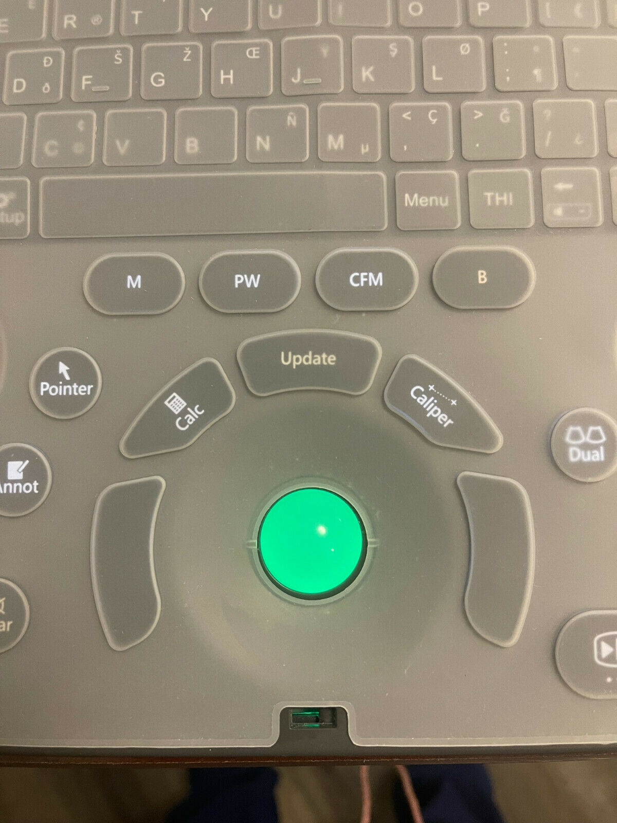 Sonoscape EXP Ultrasound Used, in Excellent condition, only used for 6 Months DIAGNOSTIC ULTRASOUND MACHINES FOR SALE