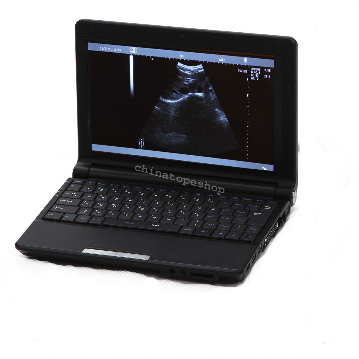 Laptop Machine Ultrasound scanner  Transvaginal probe 3D Worksation + Case 190891297143 DIAGNOSTIC ULTRASOUND MACHINES FOR SALE