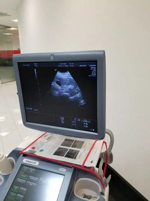 GE C4-8-D Ultrasound Probe / Transducer Demo Conditions DIAGNOSTIC ULTRASOUND MACHINES FOR SALE