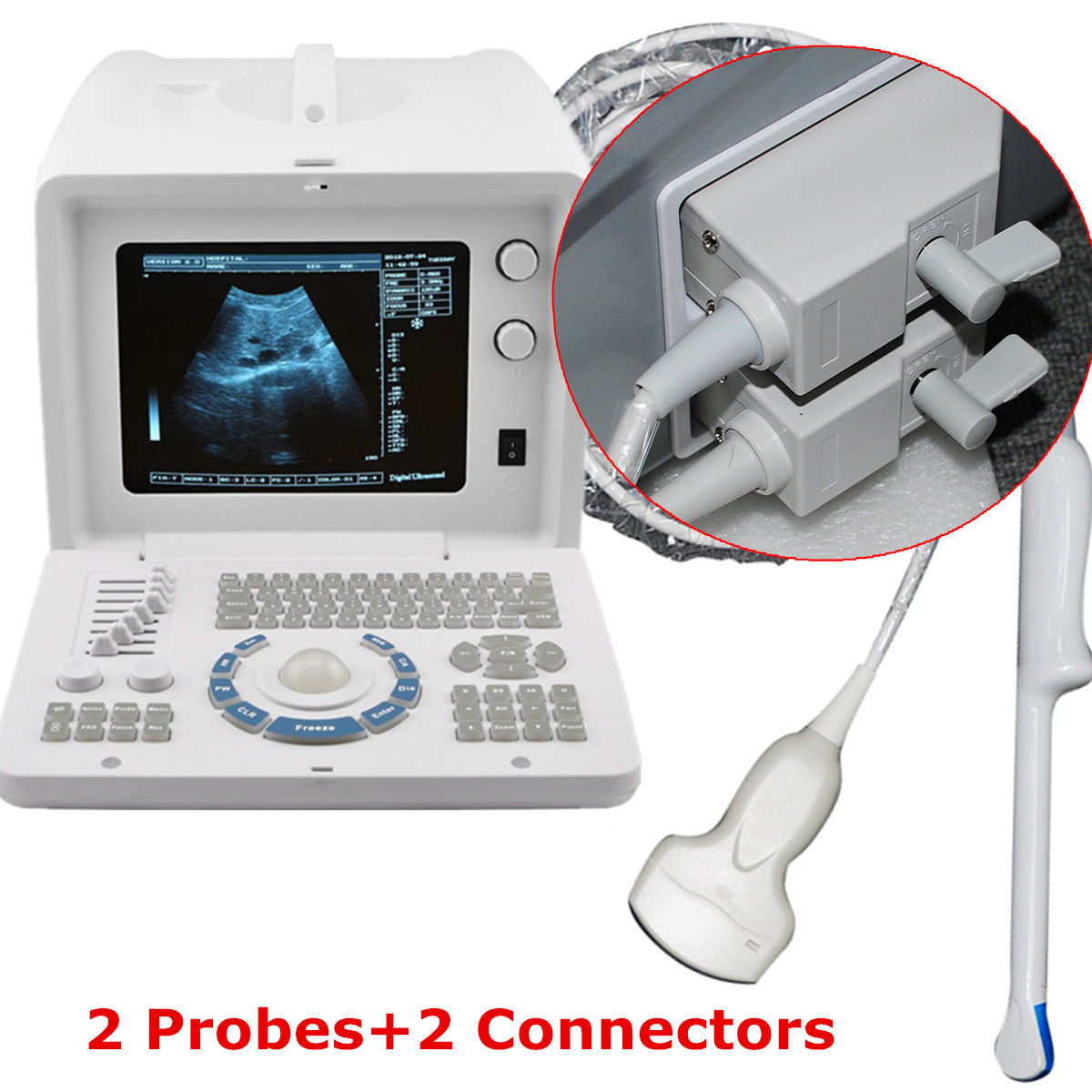 Digital B Ultrasound Scanner Machine Convex/Curved+Transvaginal  Probe Sale 3D DIAGNOSTIC ULTRASOUND MACHINES FOR SALE