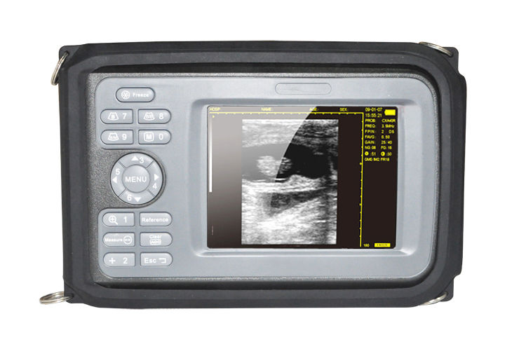 Handheld Digital Color LCD Ultrasound Scanner+7.5Mhz linear Probe For Mankind CE 190891616777 DIAGNOSTIC ULTRASOUND MACHINES FOR SALE