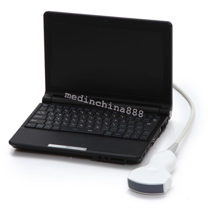 Newest Laptop Ultrasound Scanner +Convex+Linear+Transvaginal 3 Probes +Free Box DIAGNOSTIC ULTRASOUND MACHINES FOR SALE