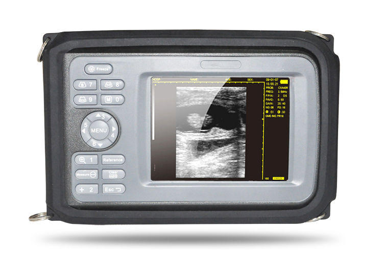 Sale Portable Handheld Digital Ultrasound Scanner Machine Linear Probe+ Oximeter 190891041111 DIAGNOSTIC ULTRASOUND MACHINES FOR SALE