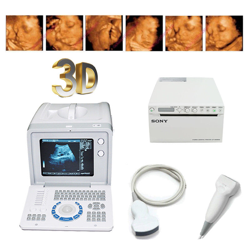 Digital Medical Ultrasound Scanner +Linear,Convex Probes+Sony UP-897MD Printer 190891974112 DIAGNOSTIC ULTRASOUND MACHINES FOR SALE