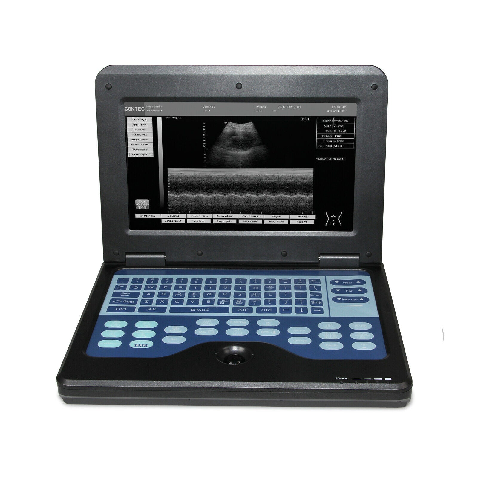 Digital Portable Ultrasound Scanner Diagnostic Machine 2 Probes Convex/Linear US DIAGNOSTIC ULTRASOUND MACHINES FOR SALE