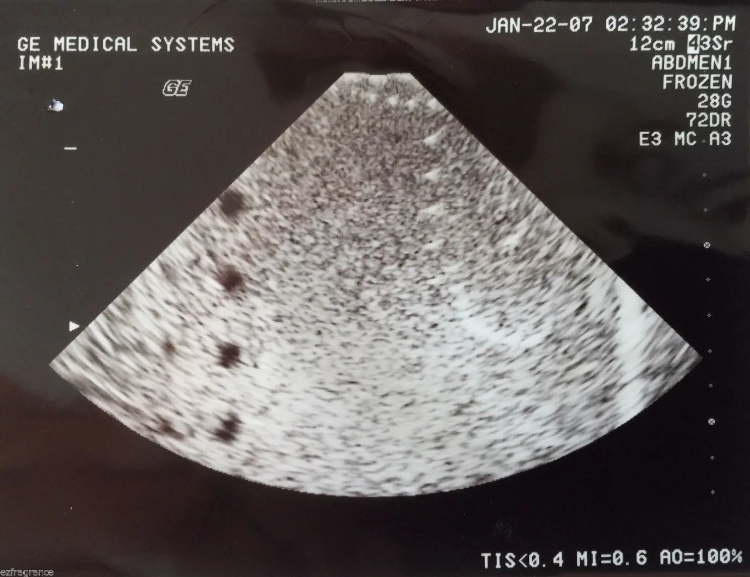 GE 3Sr Sector Cardiac Ultrasound Transducer Probe-Fully Tested For GE Logiq 700 DIAGNOSTIC ULTRASOUND MACHINES FOR SALE