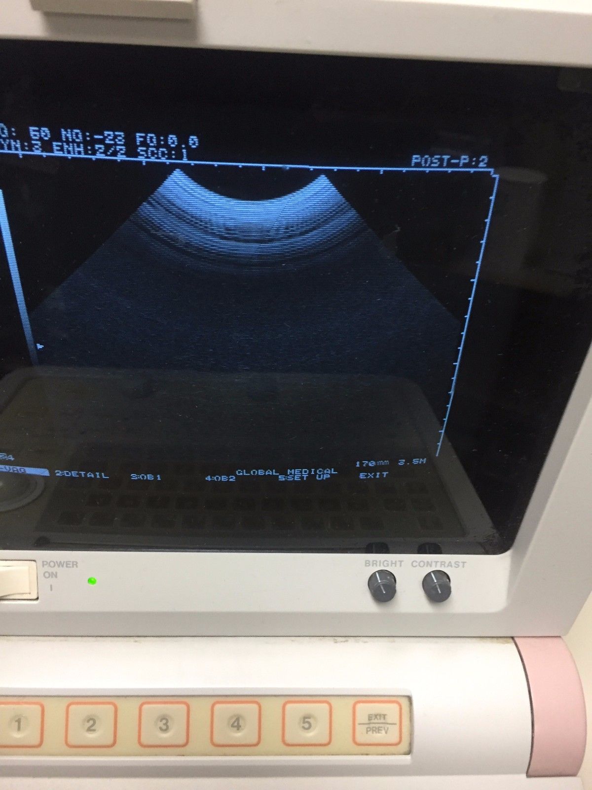 Hitachi EUB-405 Plus Ultrasound / 2 probes / 2 transducer port / printer DIAGNOSTIC ULTRASOUND MACHINES FOR SALE