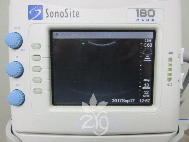 SonoSite 180 Plus Portable Ultrasound on Stand w 2 Probes, Printer and Monitor DIAGNOSTIC ULTRASOUND MACHINES FOR SALE