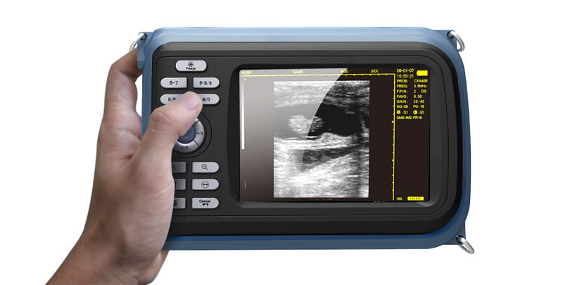 Handheld Palmtop Machine Ultrasound Scanner Cardiac Micro-Convex Probe Sale CE 190891436733 DIAGNOSTIC ULTRASOUND MACHINES FOR SALE