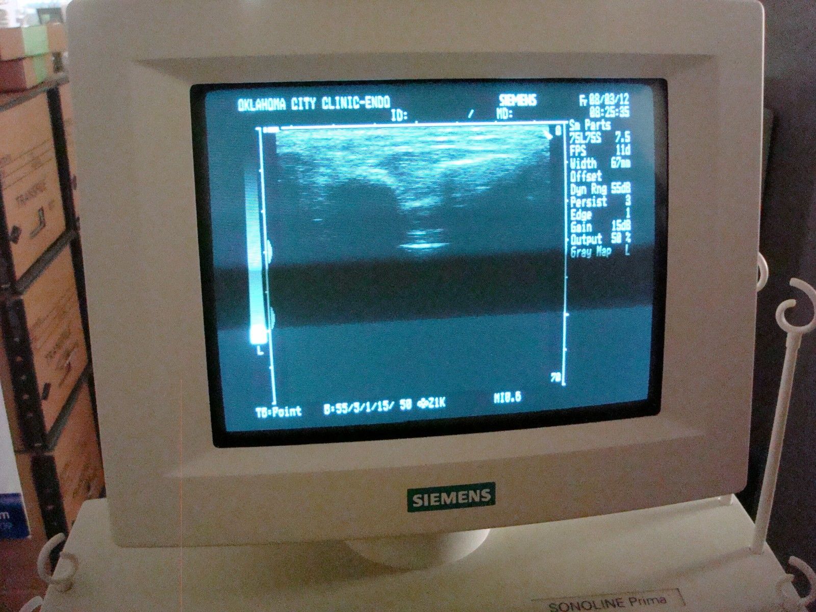 Siemens Sonoline Prima  1995 Ultrasound DIAGNOSTIC ULTRASOUND MACHINES FOR SALE