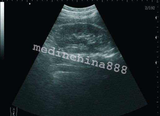 Newest Laptop Ultrasound Scanner +Convex+Linear+Transvaginal 3 Probes +Free Box DIAGNOSTIC ULTRASOUND MACHINES FOR SALE
