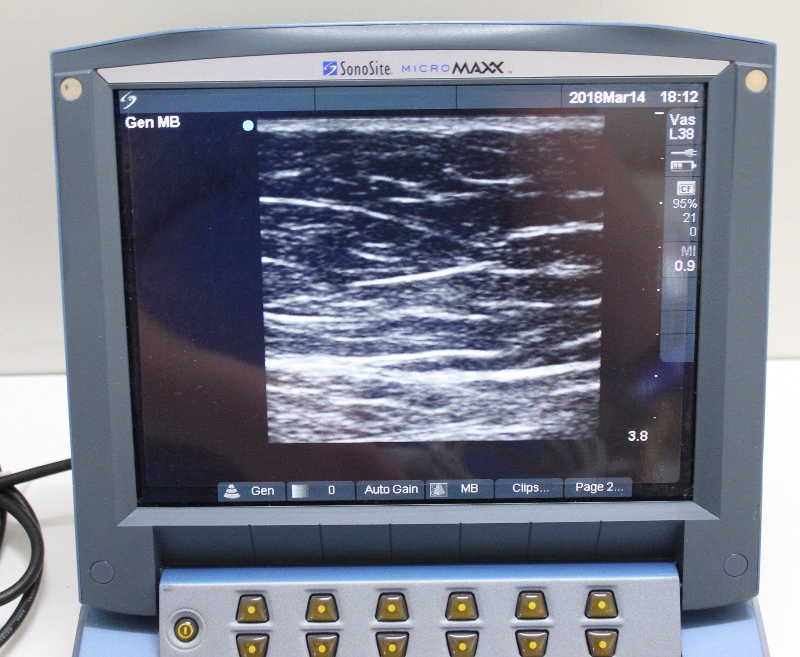 Sonosite Micromaxx Ultrasound ( please read) DIAGNOSTIC ULTRASOUND MACHINES FOR SALE