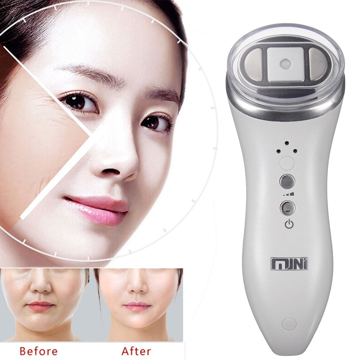 Mini High Intensity Focused Ultrasound HIFU Anti-Aging Wrinkle Removal Machine 6293442778116 DIAGNOSTIC ULTRASOUND MACHINES FOR SALE