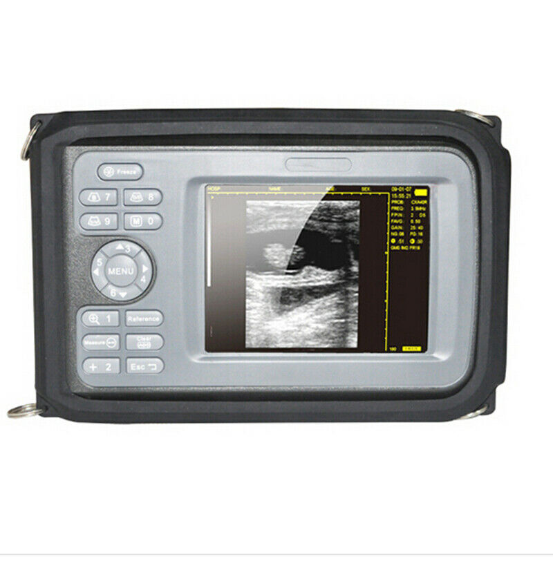 Digital LCD Ultrasound Scanner Machine Human Use With R40 3.5Mhz Convex Probe DIAGNOSTIC ULTRASOUND MACHINES FOR SALE