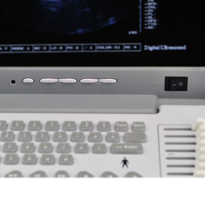 portable B Ultrasound Machine/Scanner Convex Probe ,Optional linear 3D Software 190891457189 DIAGNOSTIC ULTRASOUND MACHINES FOR SALE
