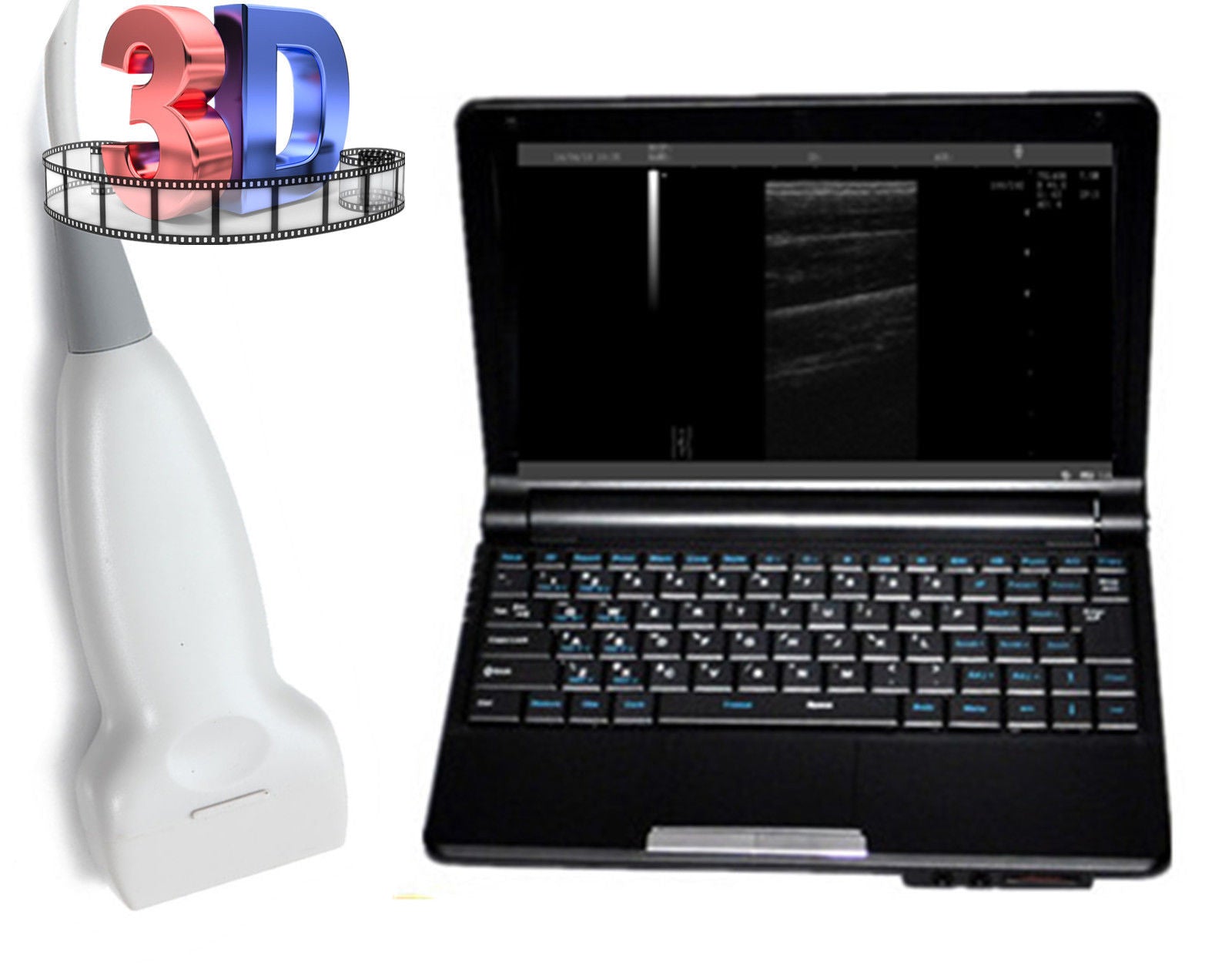Laptop Ultrasonic Machine  Ultrasound Scanner Linear Vascular Probe + Oximeter 190891797605 DIAGNOSTIC ULTRASOUND MACHINES FOR SALE