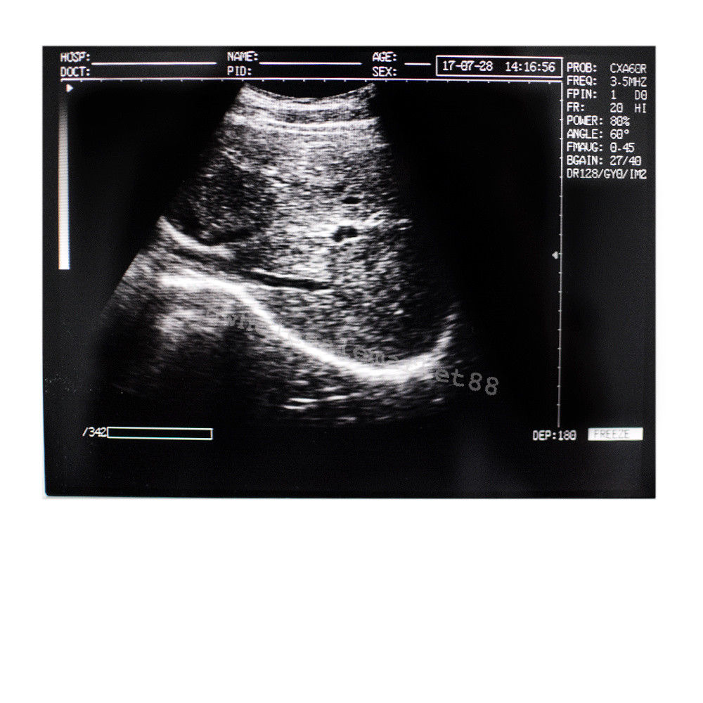 Laptop Ultrasound Machine Scanner Convex Probe 3D Software High Resolution Clear 190891045898 DIAGNOSTIC ULTRASOUND MACHINES FOR SALE