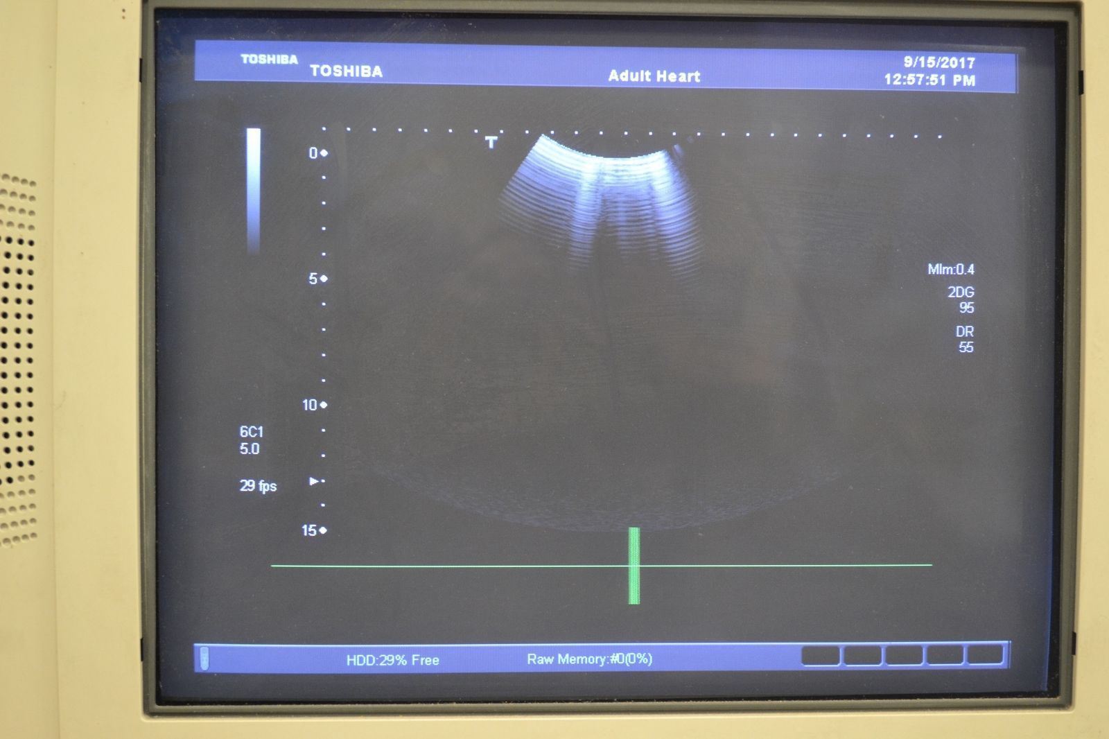 Toshiba Aplio 500 PVT-375BT 6-1.9MHz Convex Abdominal Transducer Probe DIAGNOSTIC ULTRASOUND MACHINES FOR SALE