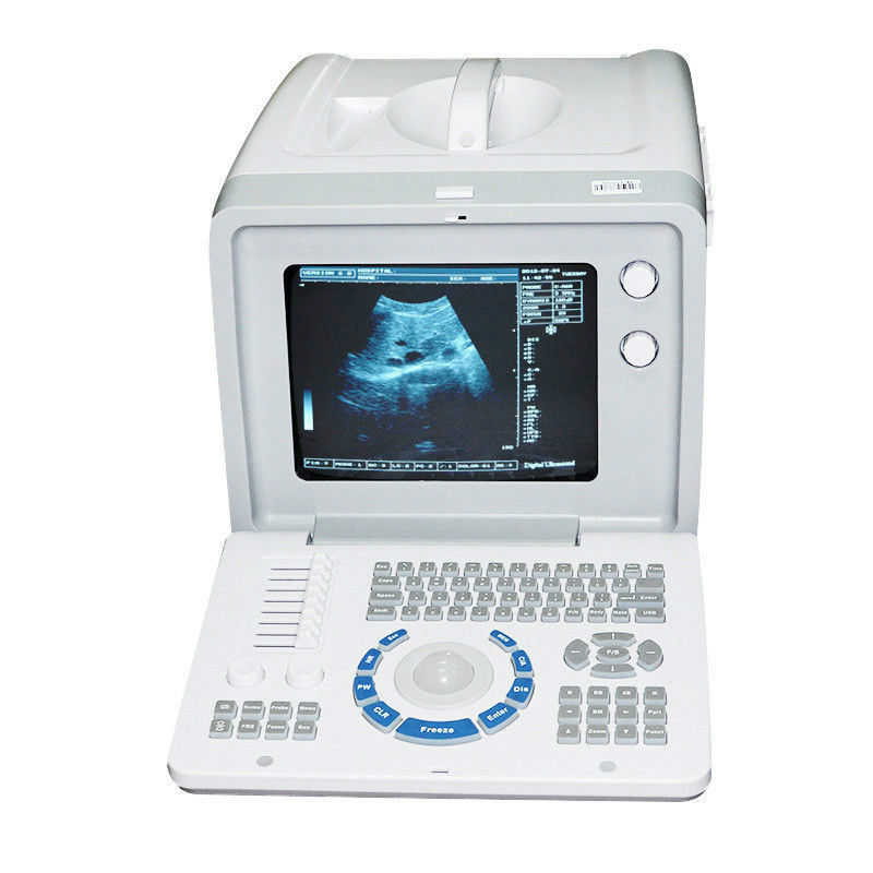 Portable Laptop Ultrasound Scanner Machine Convex +Transvaginal Probe+ 3D, DHL 190891047663 DIAGNOSTIC ULTRASOUND MACHINES FOR SALE
