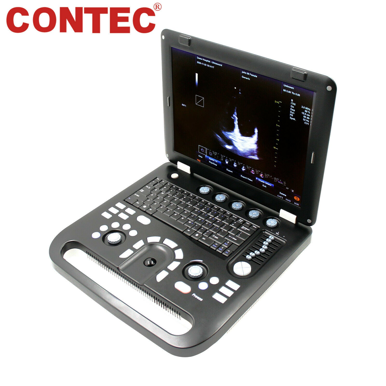 Portable Cardiac Ultrasound Scanner Diagnostic Color Doppler Phased Array Probe 6945040100362 DIAGNOSTIC ULTRASOUND MACHINES FOR SALE