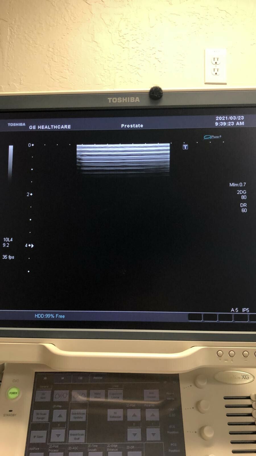 Toshiba PLT-604AT Ultrasound Transducer Probe YOM 2008 DIAGNOSTIC ULTRASOUND MACHINES FOR SALE