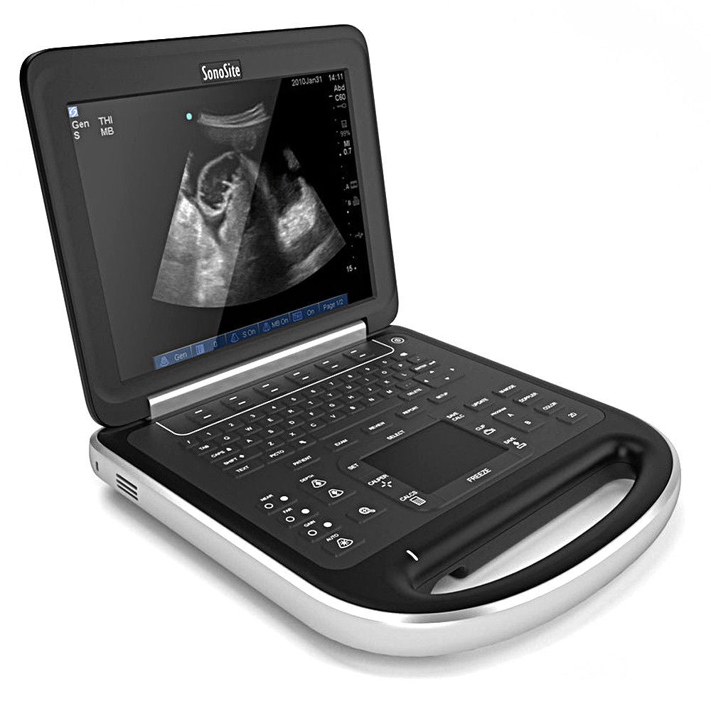 SonoSite Edge Ultrasound System Scanner Machine - Box Only - Package ON SALE DIAGNOSTIC ULTRASOUND MACHINES FOR SALE