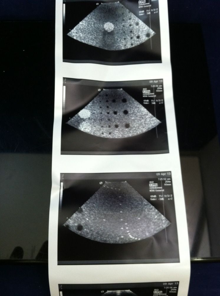 ACUSON 4V2 ULTRASOUND PROBE Sequoia 512 Excellent Cond Transducer DIAGNOSTIC ULTRASOUND MACHINES FOR SALE