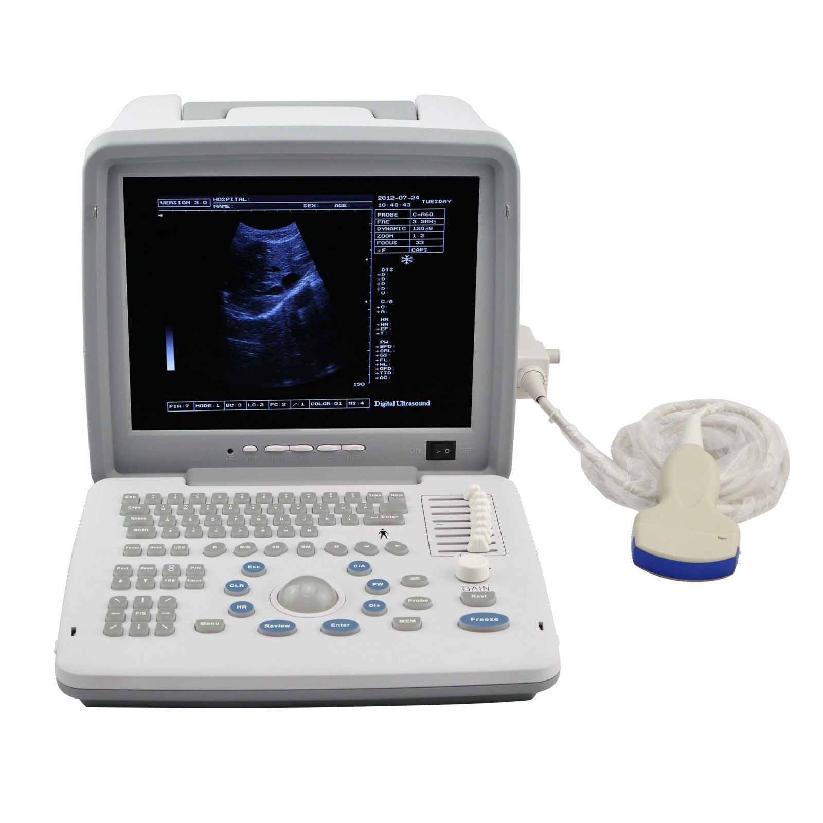 Digital Portable Ultrasound Scanner Machine + Convex & Transvaginal 2 Probes DHL DIAGNOSTIC ULTRASOUND MACHINES FOR SALE