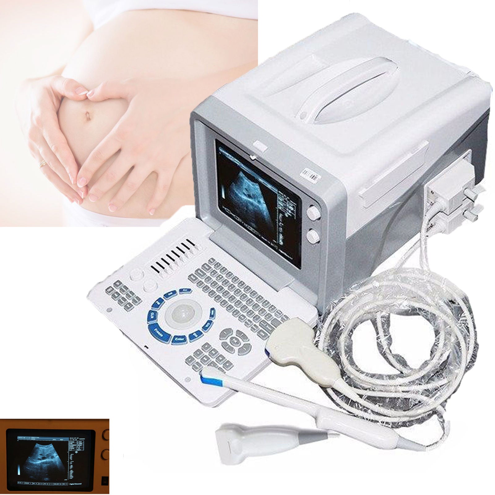 Digital Ultrasound Machine Covex/ Linear/ Transvaginal 3 Probes Digital Imaging 190891914545 DIAGNOSTIC ULTRASOUND MACHINES FOR SALE