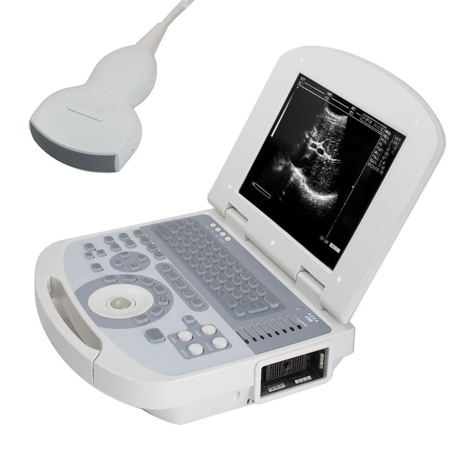 Portable Full Digital Laptop 10.4" Medical Ultrasound Scanner 3.5 Convex probe DIAGNOSTIC ULTRASOUND MACHINES FOR SALE