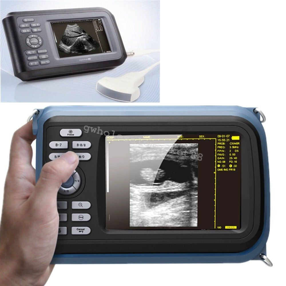 HandScan Full Digital Ultrasound scanner Machine Convex+ Transvaginal probe Case DIAGNOSTIC ULTRASOUND MACHINES FOR SALE