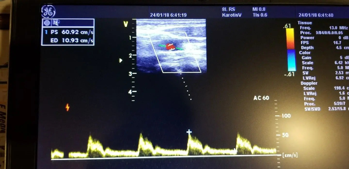 GE 8L-RS Ultrasound Probe / Transducer DIAGNOSTIC ULTRASOUND MACHINES FOR SALE