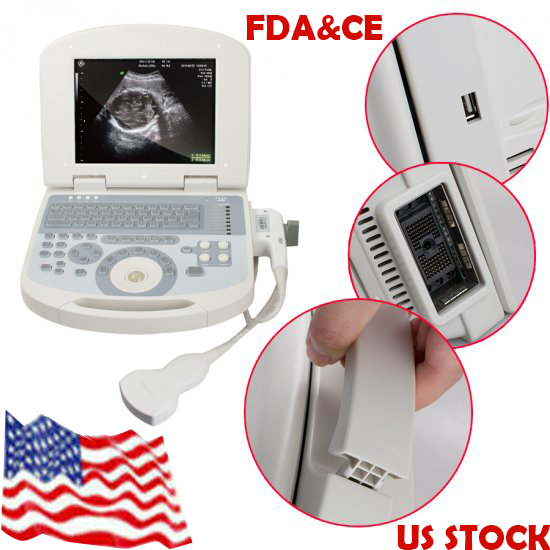 10.4inch Portable Digital Medical Laptop Ultrasound Scanner Machine+Convex probe DIAGNOSTIC ULTRASOUND MACHINES FOR SALE