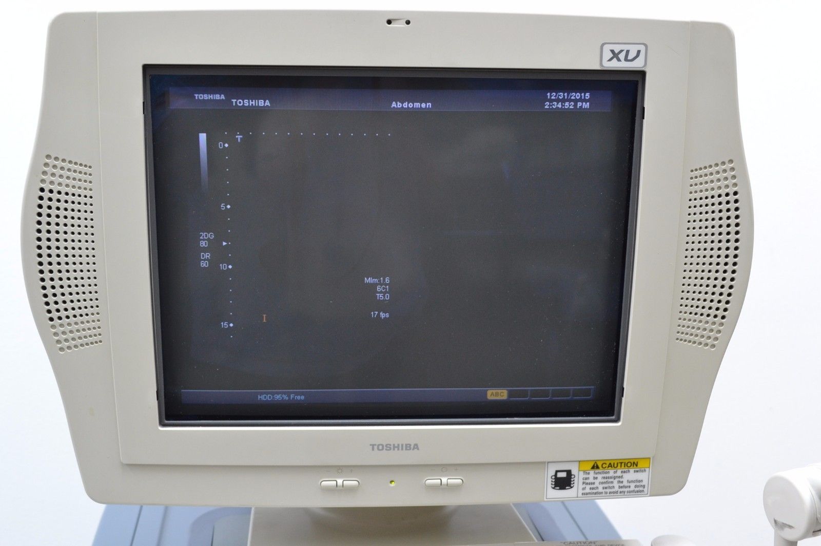 Toshiba SSA-770A Aplio XV Diagnostic Ultrasound W/ PVT-385BT/ PLT-1204AT Probes DIAGNOSTIC ULTRASOUND MACHINES FOR SALE