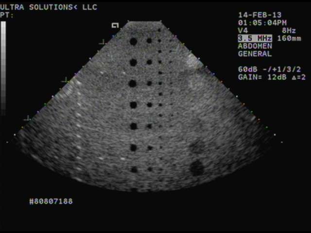 Acuson V4 Ultrasound Transducer DIAGNOSTIC ULTRASOUND MACHINES FOR SALE