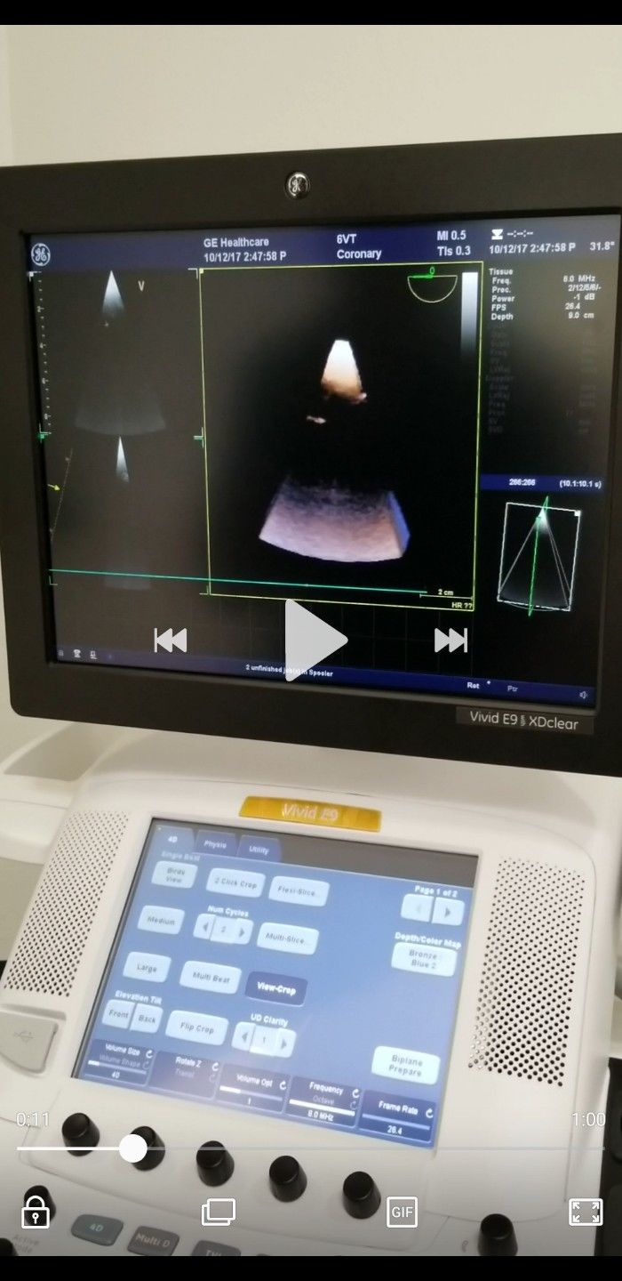 GE 6VT-D Ultrasound Probe / Transducer Demo Condition DIAGNOSTIC ULTRASOUND MACHINES FOR SALE